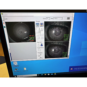 Corneal Topographer TMS-4N