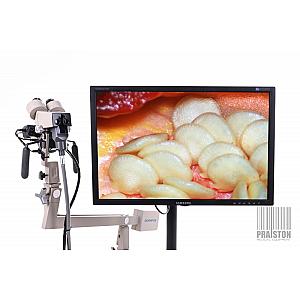 Colposcope OCS-2
