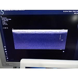 AIXPLORER® scanner de ultra-sons