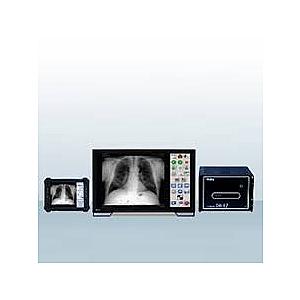 X-FRAME DR-EZ Digital X-ray Machine