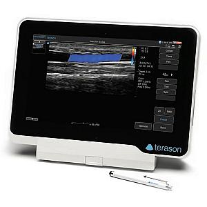 Ecógrafo portátil uSmart3200T