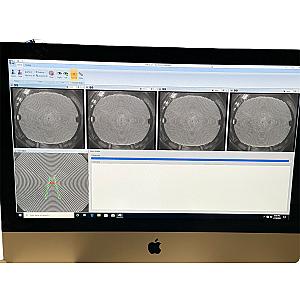 Corneal Topographer E300