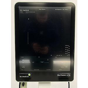 Ultrasound FLEX FOCUS 800