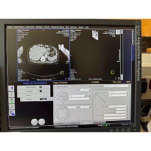 Scanner CT SOMATOM Confidence