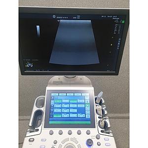 Ultrasound LOGIQ P7