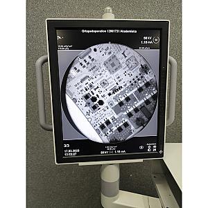 OEC Fluorostar Compact 7900 Radiography System	