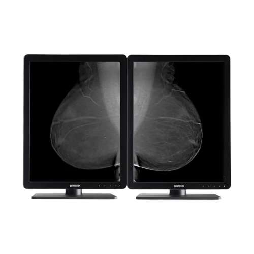 Monitor médico monocromo Nio 5MP LED (MDNG-5221)