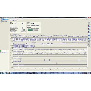Xevo TQ-S Mass Spectrometer