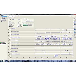 Xevo TQ-S Mass Spectrometer