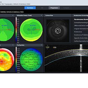 OCT multifunções HOCT-1F 