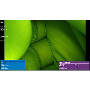 Videoscopio WA50042A