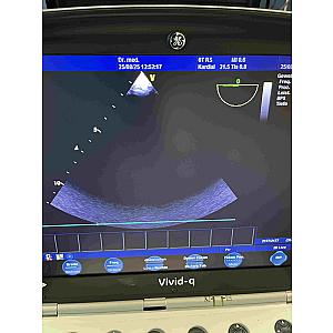 Sonde d'échocardiographie transœsophagienne 6T-RS TEE