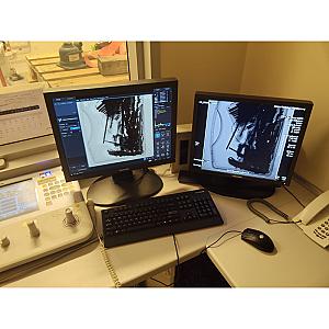 Ultimax-i Radiology System - Toshiba - Remma