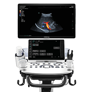 Slit lamp SL-D2 - Topcon - Remma